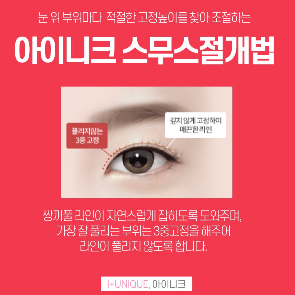 나에게 맞는 쌍꺼풀추천받고 싶다면 아이니크성형외과에서 관련 이미지 4