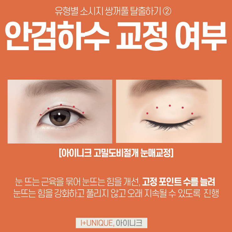 쌍수잘하는병원 아이니크성형외과 관련 이미지 5