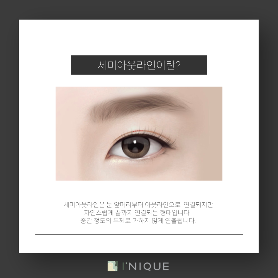 Gangnam Female Eye Surgery: How to Find the Line That Suits You image 5