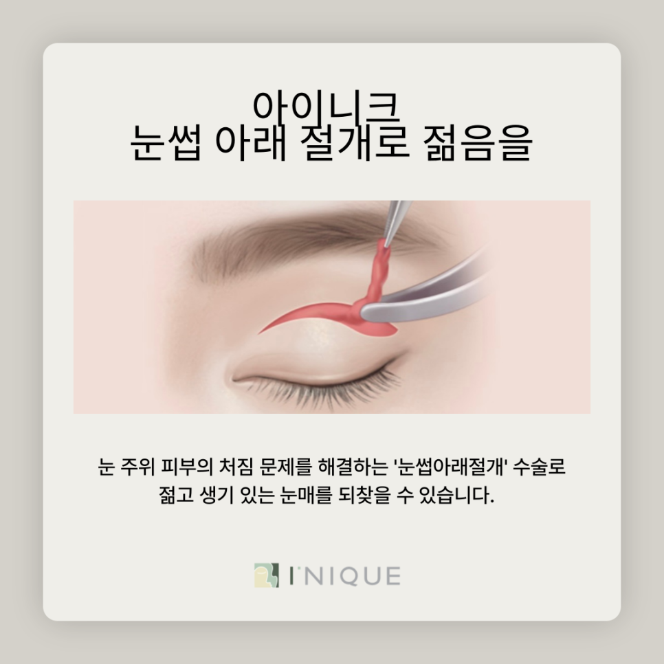 눈썹아래절개로 생기 되찾기 관련 이미지 4