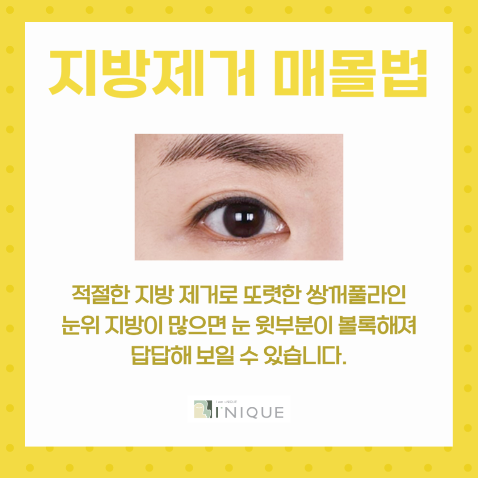 If you want to know where to find the best place for double eyelid surgery in Gangnam image 5