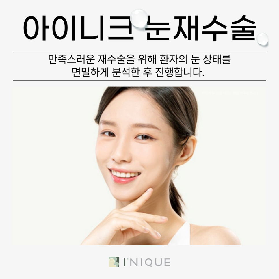 소세지쌍꺼풀재수술, 고민되시나요? 관련 이미지 3