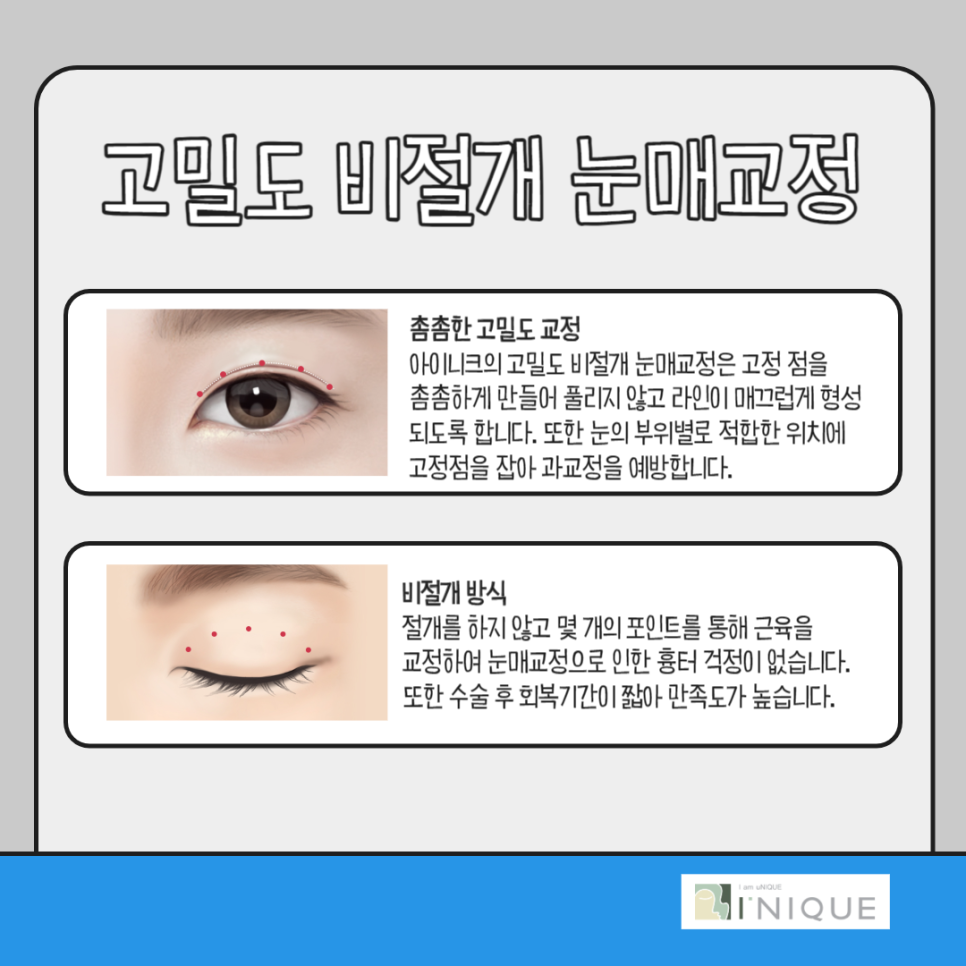 처진눈성형, 또렷한 눈매를 위한 가장 확실한 방법 관련 이미지 5