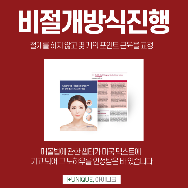 남자눈매교정병원은 더욱 신중해야한다 아이니크성형외과 관련 이미지 4