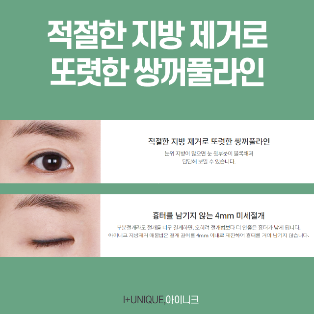 쌍꺼풀수술, 나만을 위한 디자인을 원한다면? 관련 이미지 5