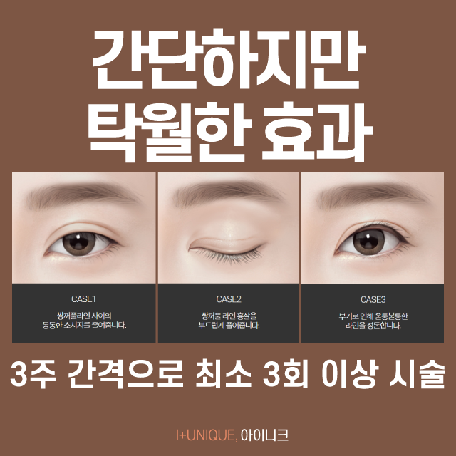 Can Swelling After Double Eyelid Surgery Be Fixed Only with Reoperation? Now It Can Be Done Easily with a “Sausage Injection”! image 5