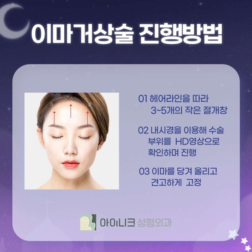 내시경이마거상술가격 후회 없는 선택하기 관련 이미지 4