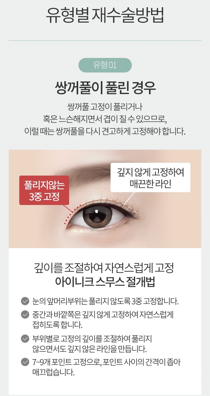 눈꺼풀지방이식비용 자연스러운 눈매로 변신 관련 이미지 3