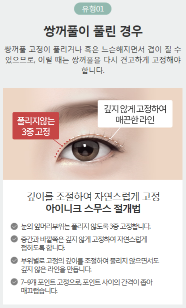 쌍커풀여러겹이 생겨 고민이라면 아이니크로! 관련 이미지 3