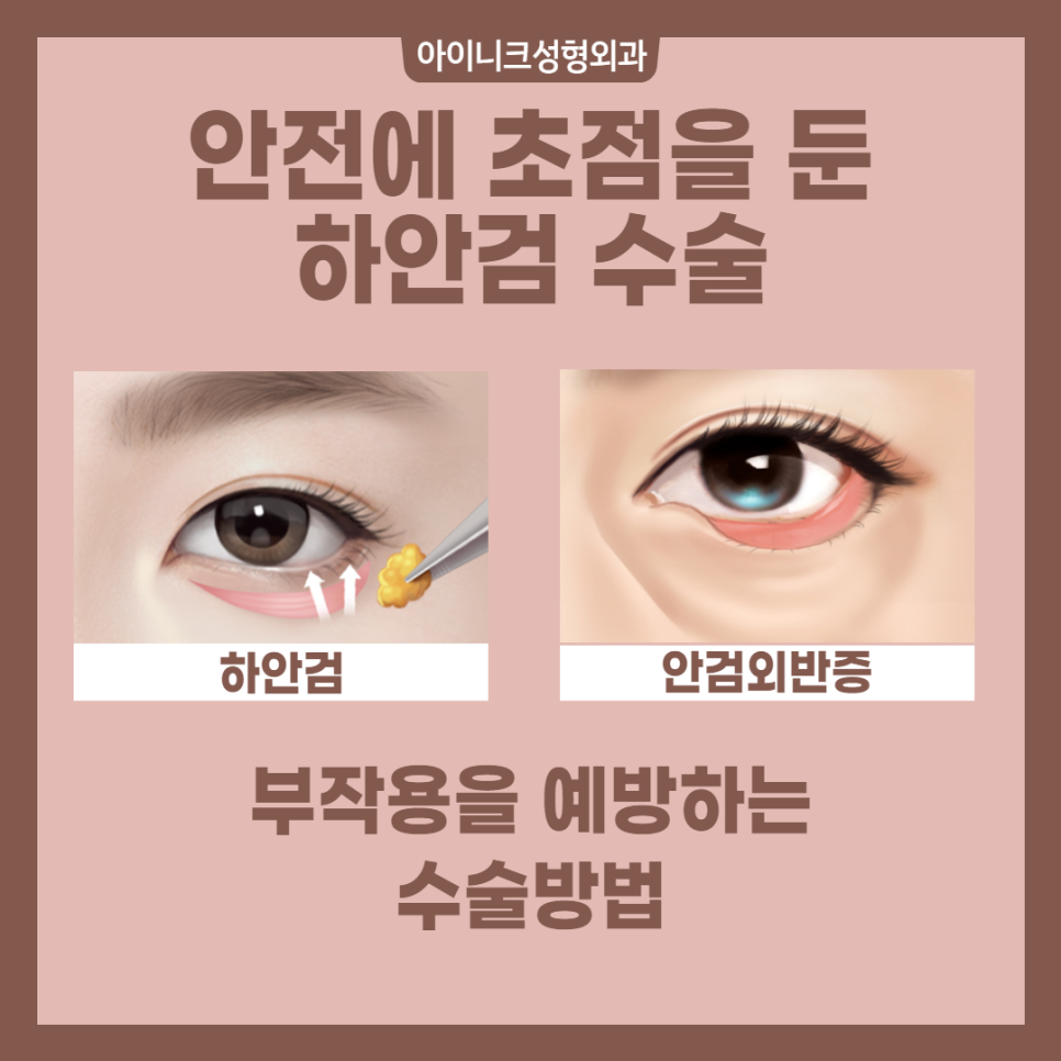 중년성형외과 확실한 효과를 원한다면? 관련 이미지 4