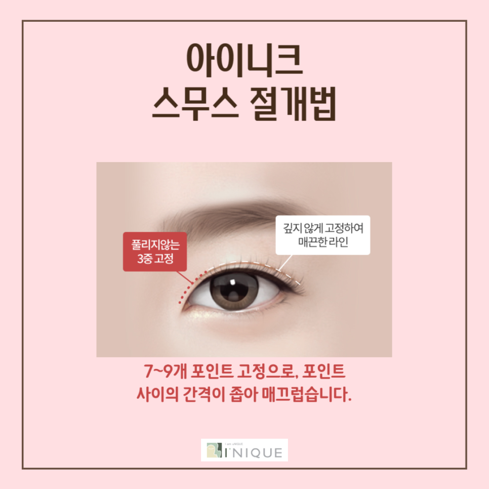 강남쌍꺼풀 자연스럽게 예뻐지는 방법 관련 이미지 5