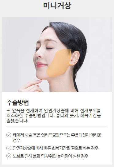 안면거상술비용 만족하실 수 있습니다. 관련 이미지 4