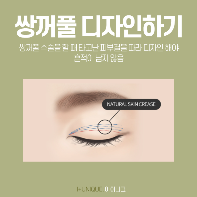 티안나는쌍꺼풀을 만들기 위한 방법? 관련 이미지 5
