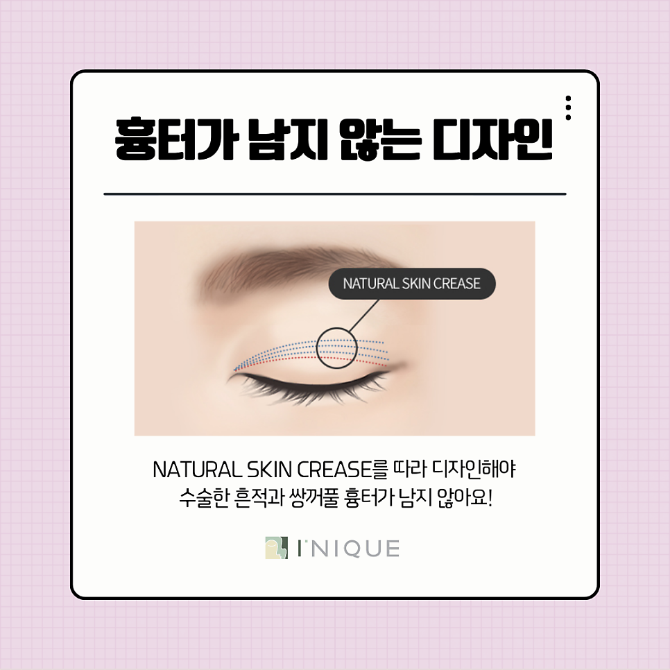 쌍꺼풀 절개 흉터 없애는 법과 관리법 총정리! 관련 이미지 7