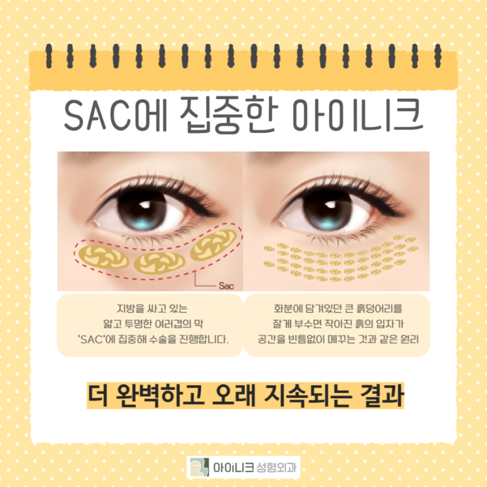 눈밑지방재배치주의사항 꼭 확인하세요! 관련 이미지 3