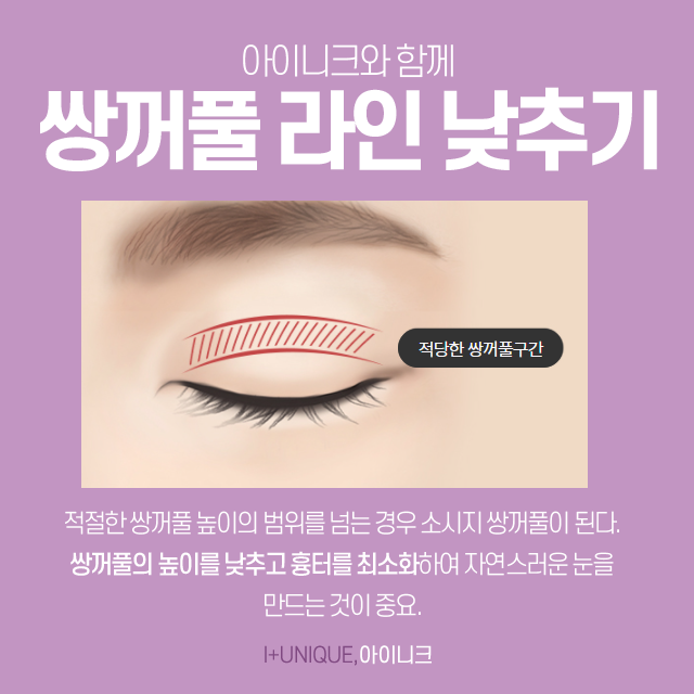 Want to Lower Your Double Eyelid Line? For Revision Surgery, Choose a Place You Can Trust! image 4