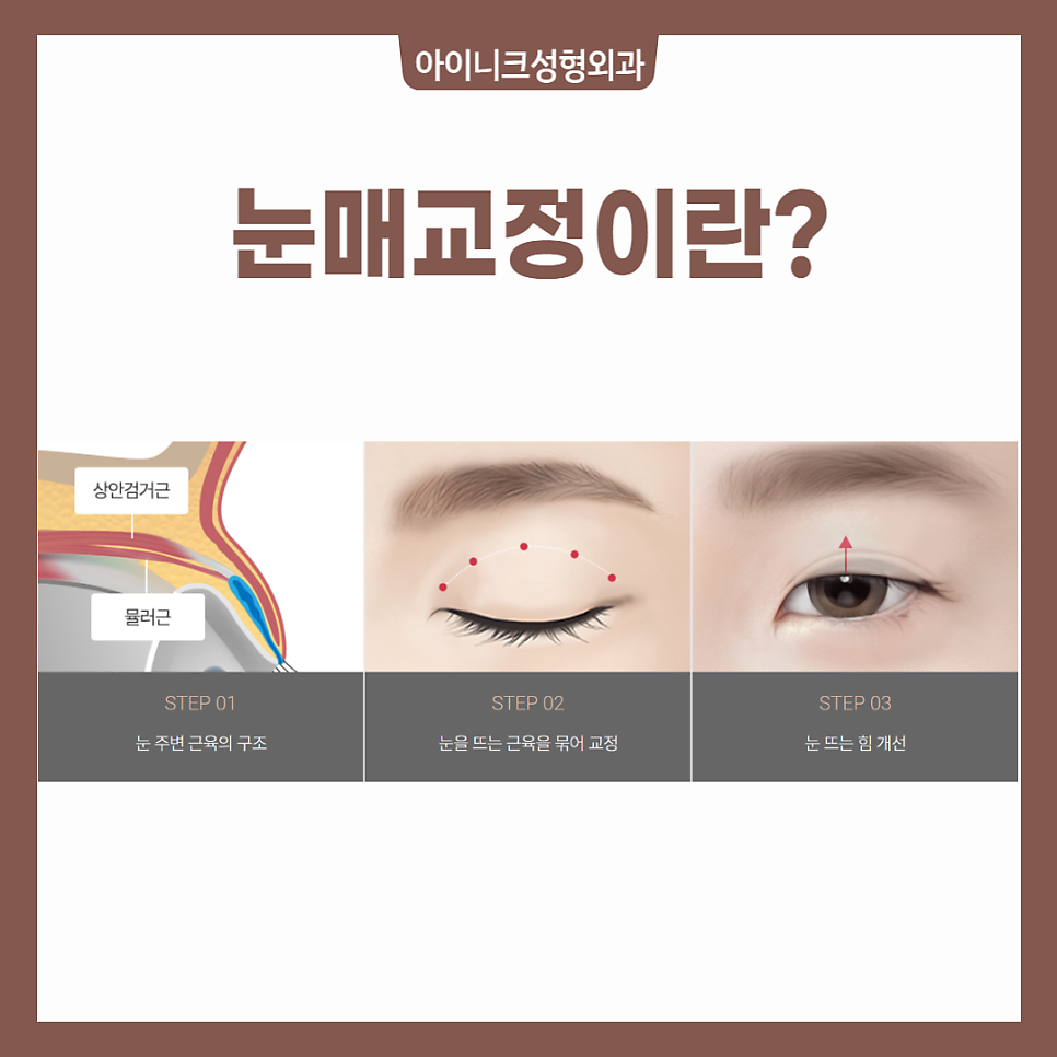 When Ptosis Correction Is Needed image 3