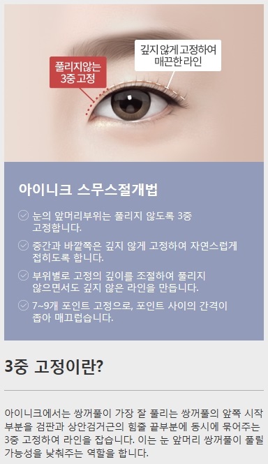 쌍수절개법 특별한 노하우 공개 관련 이미지 4