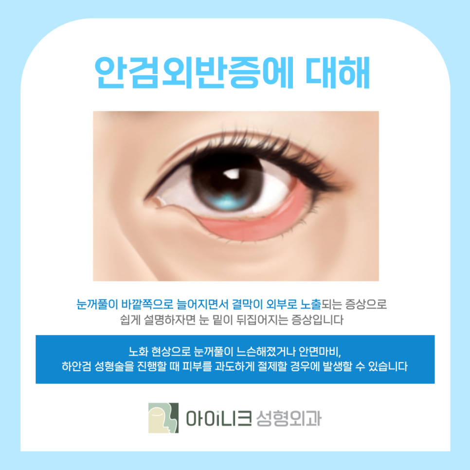 눈가리프팅 중년 눈성형으로 10년 어려보이기 관련 이미지 8