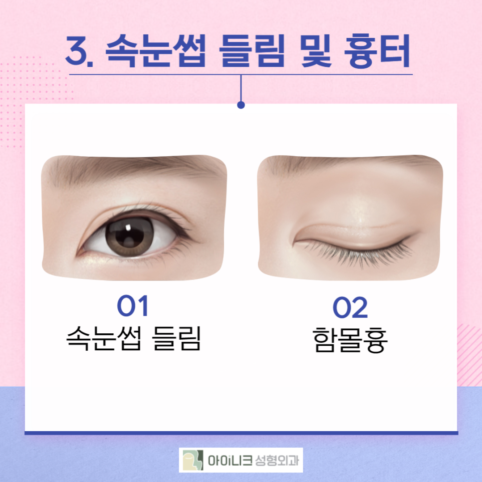 첫번째성형외과가 마지막이 되려면 관련 이미지 5