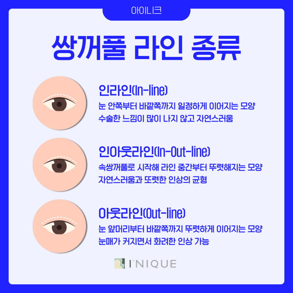 압구정 쌍수 라인 추천 어떻게? 관련 이미지 4