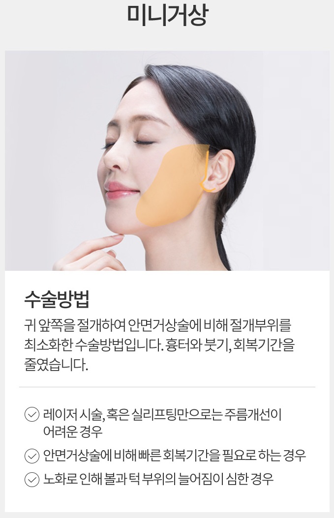 안면거상술재수술 고민 중이라면? 관련 이미지 5