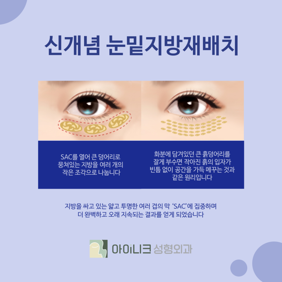 눈밑지방재배치잘하는곳 수술 후 주의사항 및 노하우 관련 이미지 5