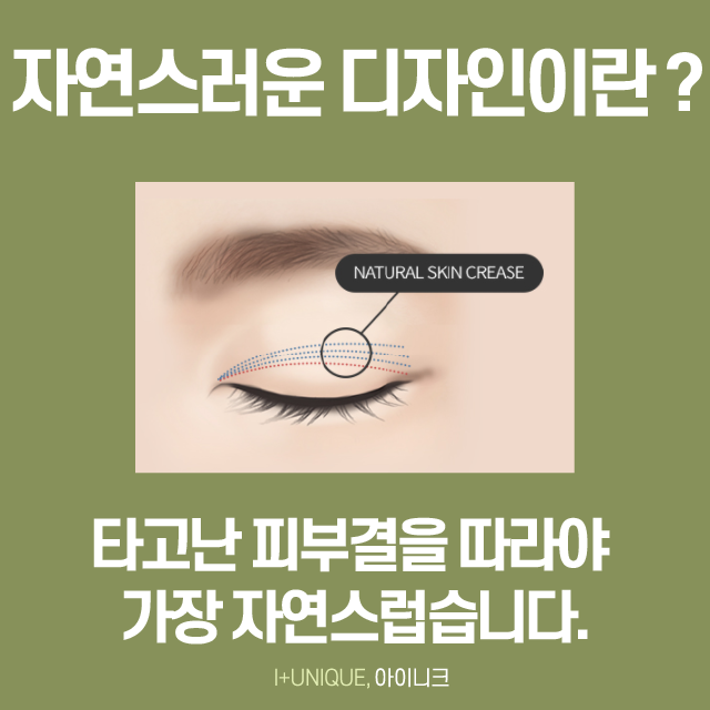 서울에서 쌍꺼풀수술을 가장 잘하는 곳을 찾고 있다면? 클릭! 관련 이미지 5