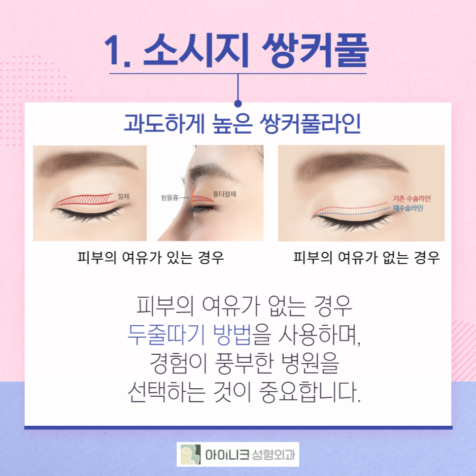 첫번째성형외과가 마지막이 되려면 관련 이미지 3
