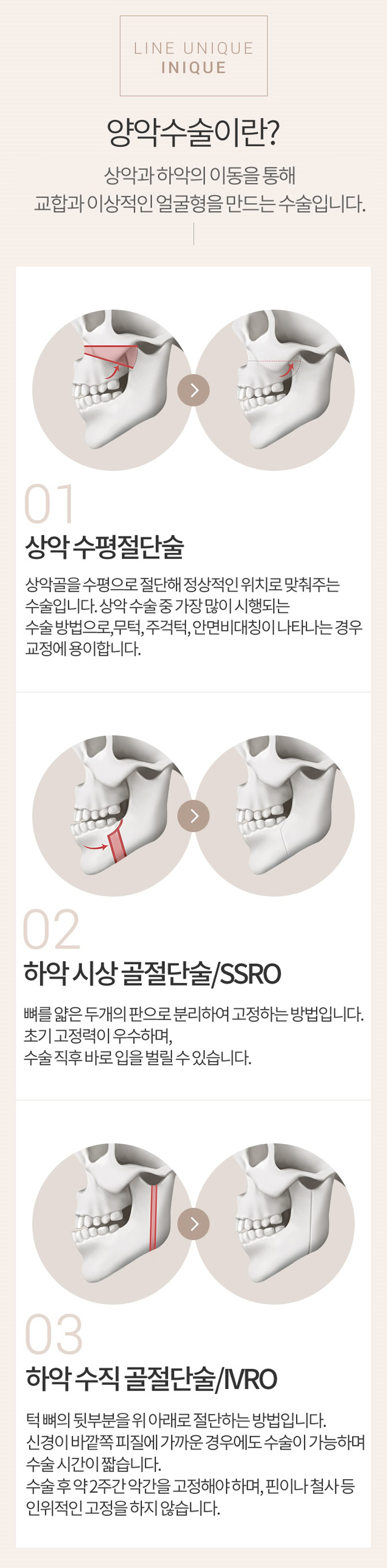 긴얼굴양악수술로 황금비율 되다! 관련 이미지 2