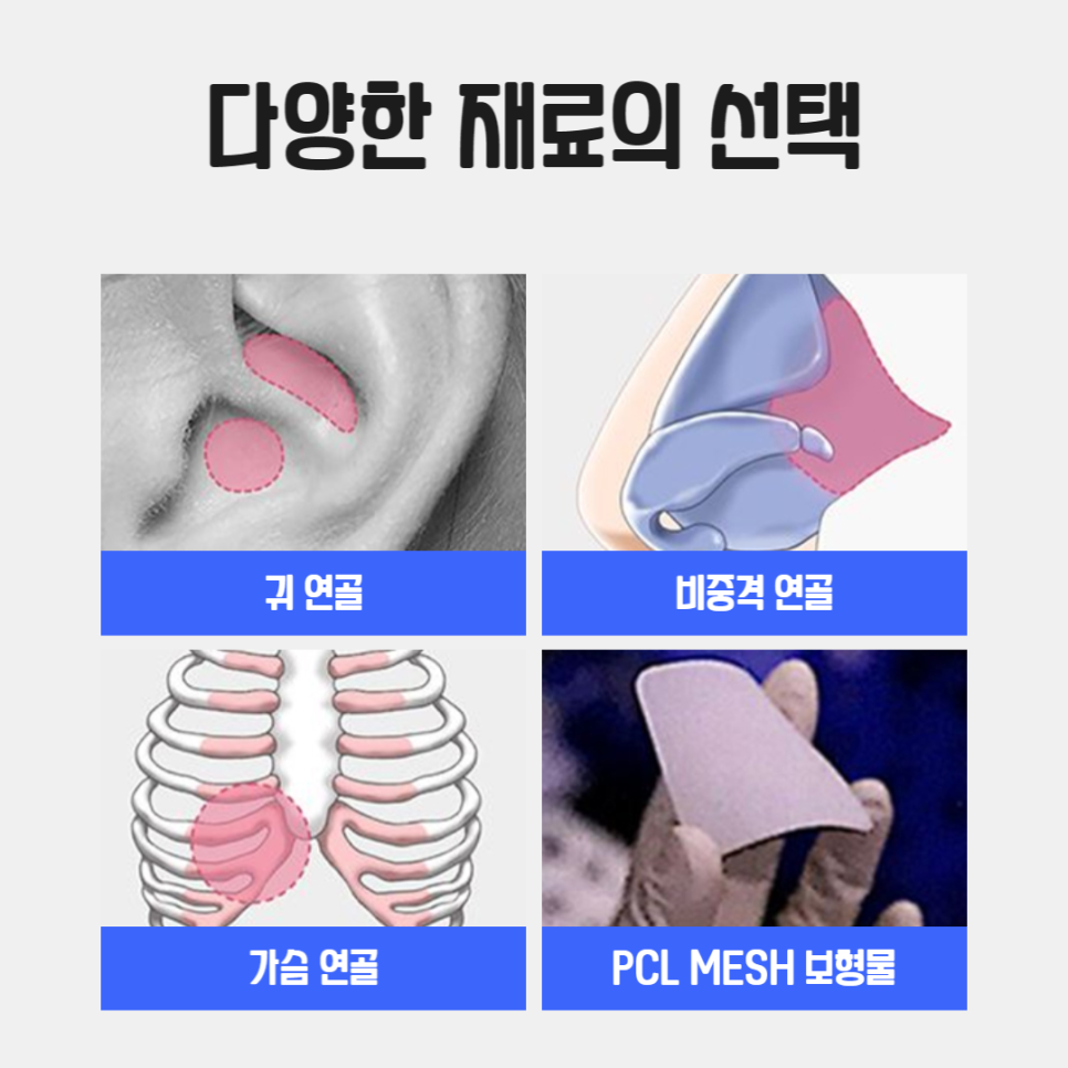 Are you looking for a famous place for revision rhinoplasty? image 5