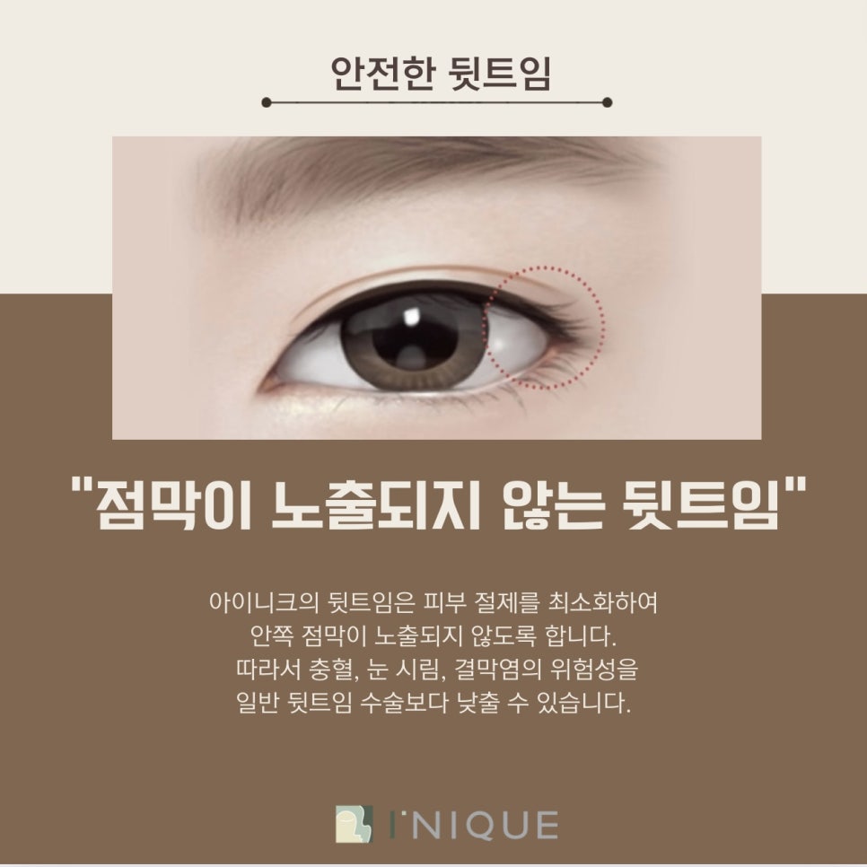 Inner Corner Eye Surgery Recommendation: Who Is It Suitable For? image 5