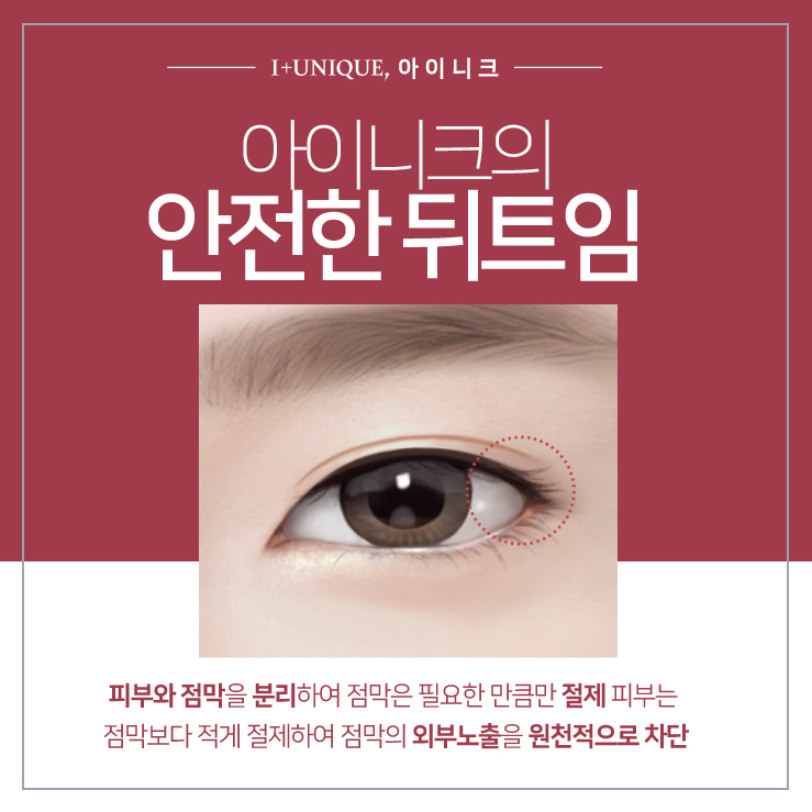 부작용 심한 뒤트임 아이니크성형외과에서 신중하게 관련 이미지 3