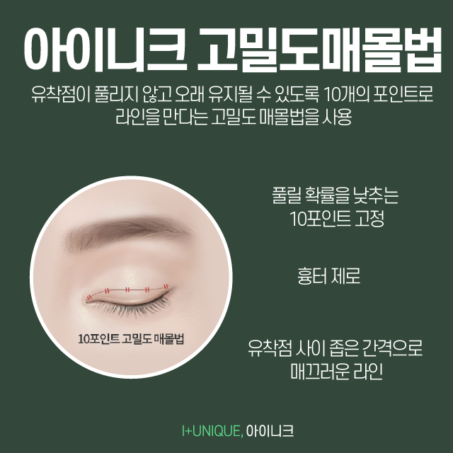 쌍꺼풀수술잘하는곳 아이니크에서 알려주는 자연스러운 쌍수요소 관련 이미지 4