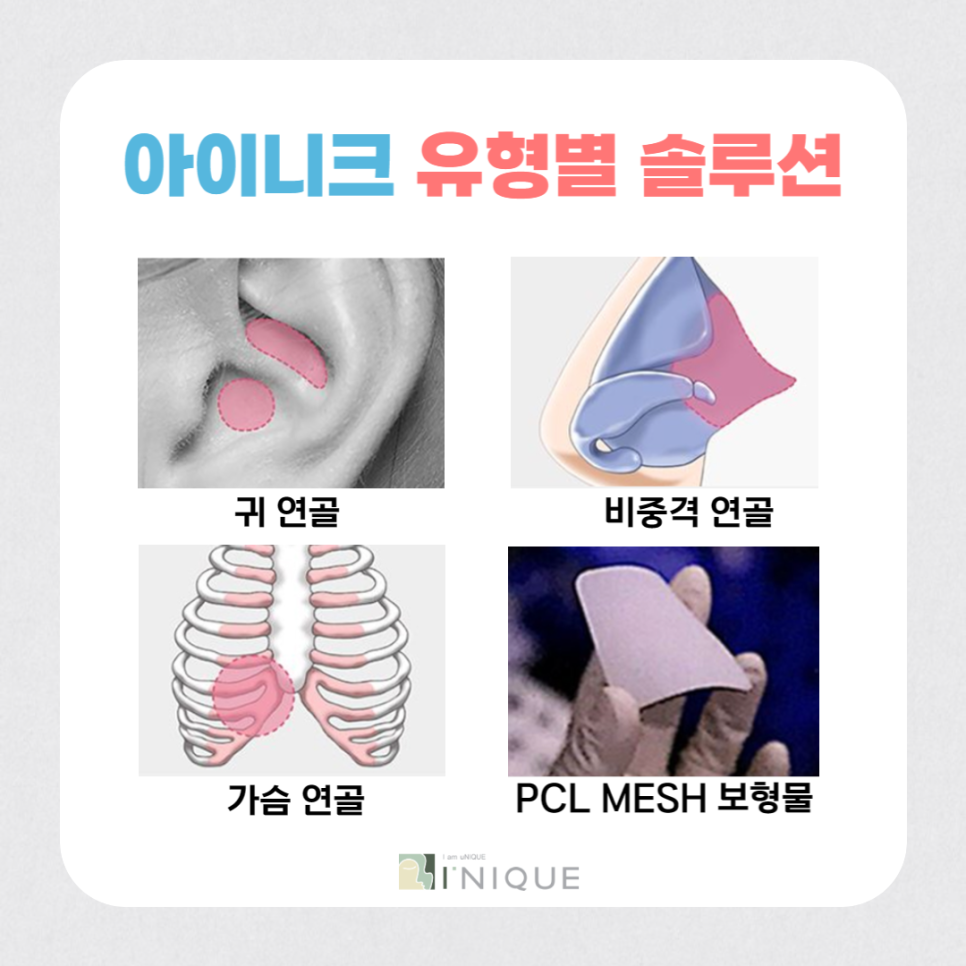 코끝성형후기가 증명하는 아이니크 관련 이미지 4