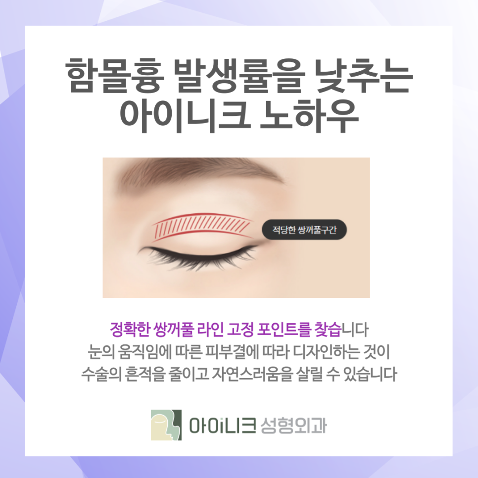 청담동 쌍꺼풀수술 추천 흉터를 줄이는 방식 관련 이미지 6