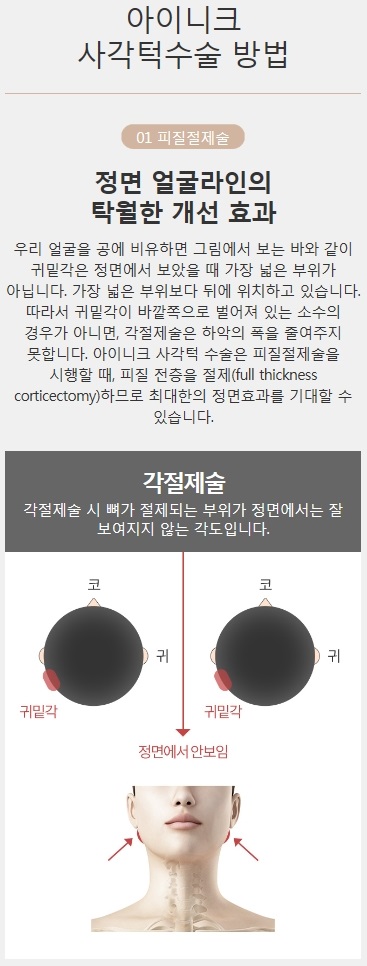사각턱재건 실패 없이 완성된 얼굴 관련 이미지 3