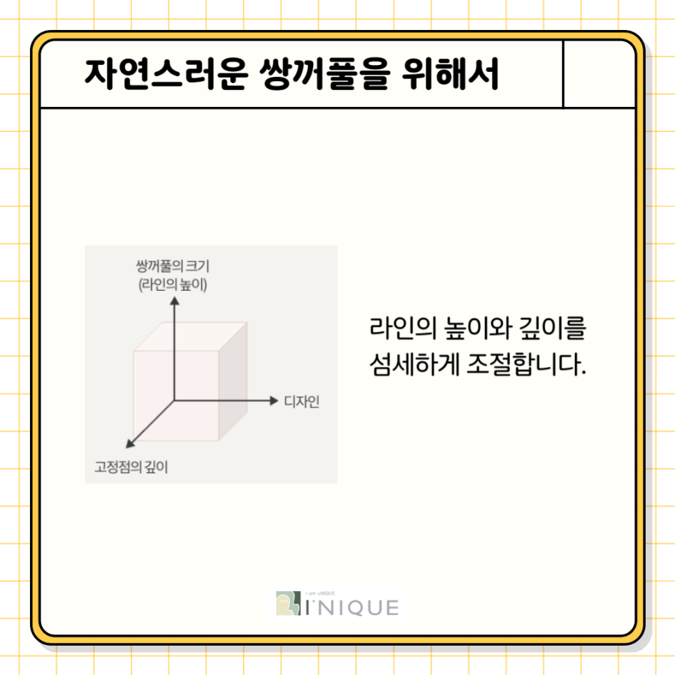 눈성형전후 확실한 변화를 원한다면 관련 이미지 2