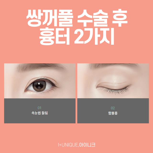 흉터,재수술이 필요하다면 강남쌍꺼풀재수술 잘하는곳 아이니크에서! 관련 이미지 2