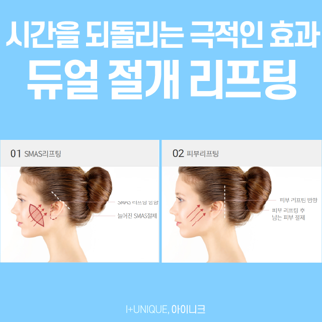 Finding the Right Revision Facelift Method for Me, from the Face to Under the Chin image 5