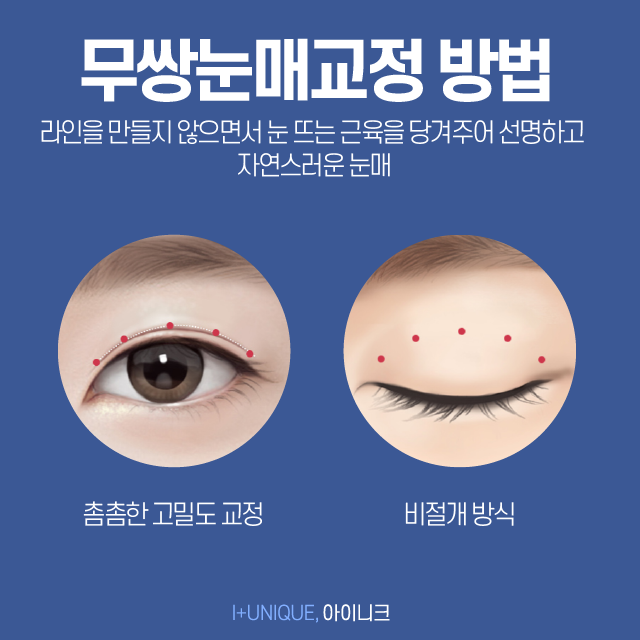 남자쌍커풀수술도 얼마나 자연스럽냐가 관건! 관련 이미지 4