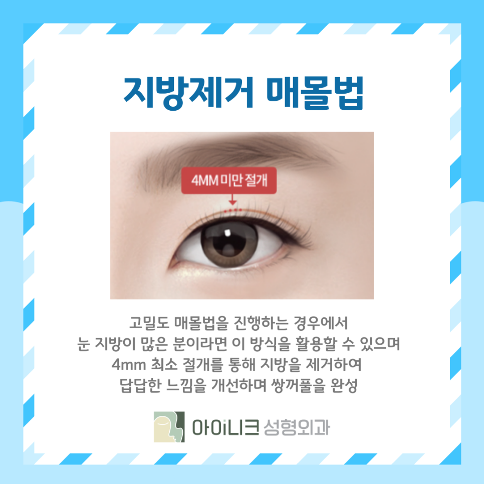 What Is the Right Choice Among Double Eyelid Surgery Types: Suture or Incisional? image 10