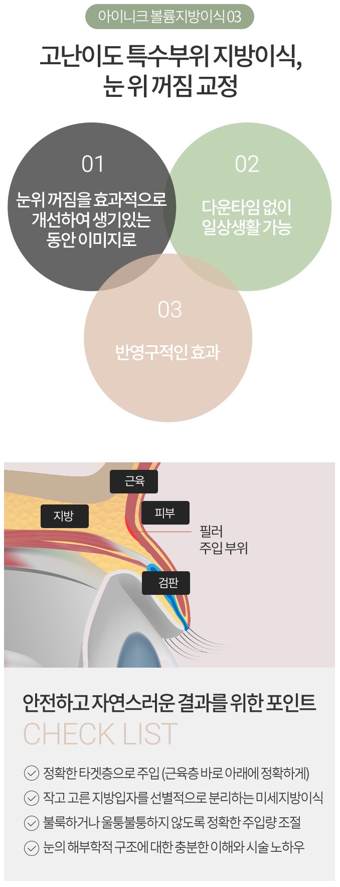 눈꺼풀지방이식 의료진 선택이 중요 관련 이미지 5