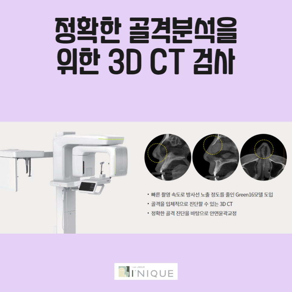콧볼성형 하기 전 체크사항! 관련 이미지 3