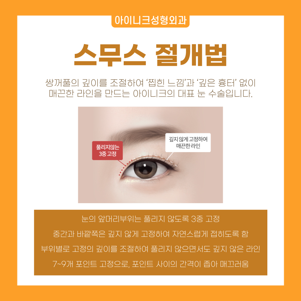 쌍수성형외과 자연스러움을 원한다면 눈성형전문 아이니크로 관련 이미지 5