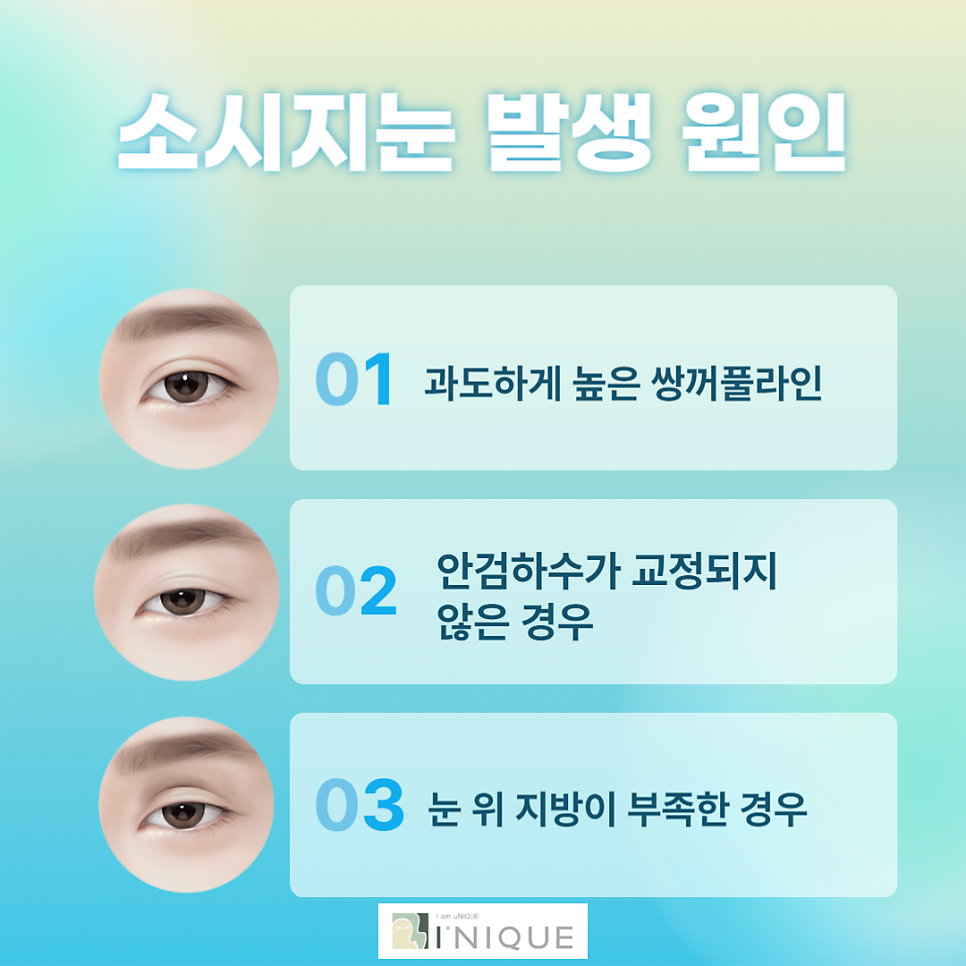 소시지눈 어떻게 하면 해결할 수 있을까? 관련 이미지 2