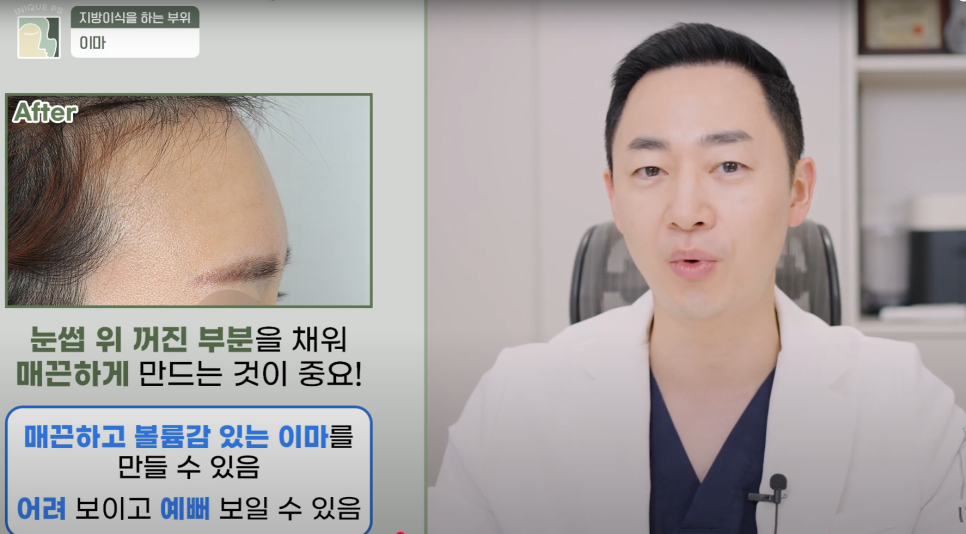 Look Younger with Gangnam Encore Under-Eye Fat Grafting! image 7