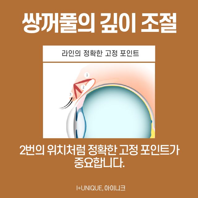 20대눈성형 자연스러움이 최고 관련 이미지 4