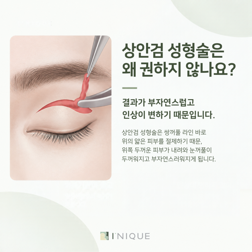 상안검수술, 권하지 않는 이유가 궁금하다면 관련 이미지 5