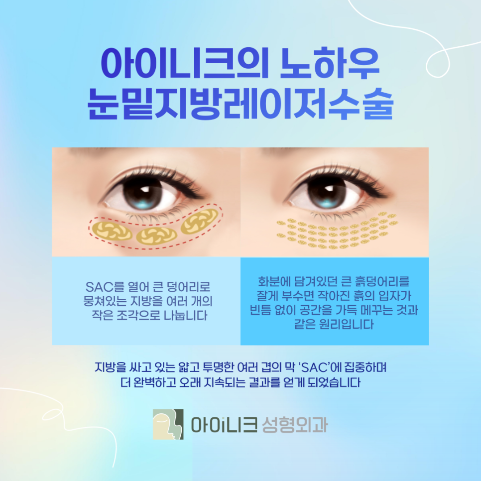 눈밑지방레이저수술 만족스러운 결과를 얻으려면 관련 이미지 4